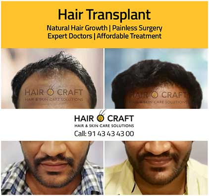 Hairocraft-global2