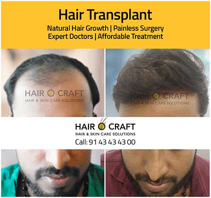 Hairocraft-global4