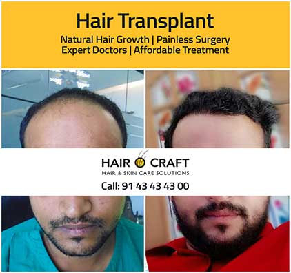 Hairocraft-global5