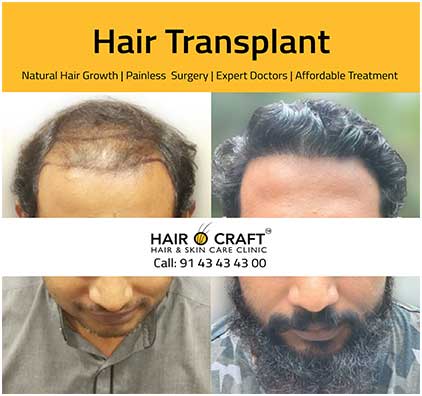 Hairocraft-global6