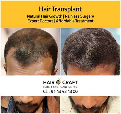 Hairocraft-global1.jpg